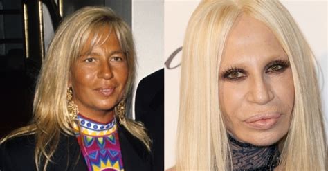 donatella versace antes e depois|Donatella Versace style.